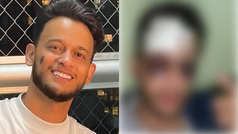 Reprodução/Redes Sociais/Caras