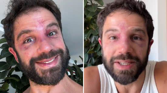 Reprodução / Redes sociais