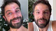 Reprodução / Redes sociais