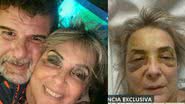 Reprodução // RPTV