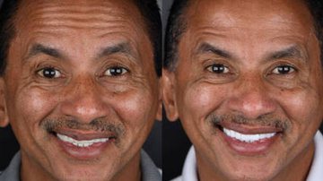 Reprodução/ Instagram