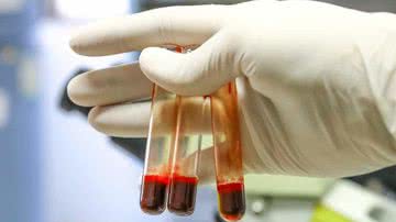 benchamat1234/ Istockphoto