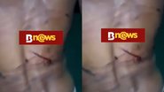Reprodução/Vídeo