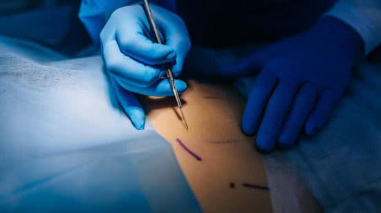 Ilustrativa/ Freepik