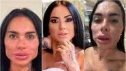 Reprodução / Redes Sociais