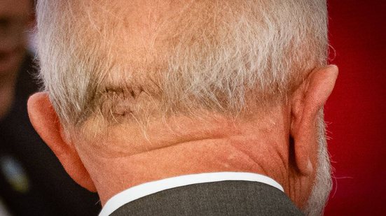 Hugo Barreto/Metrópoles @hugobarretophoto