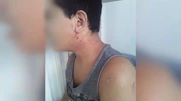 Imagem Mãe denuncia clínica psiquiátrica por maus-tratos contra filho autista de 13 anos