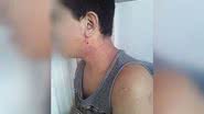 Imagem Mãe denuncia clínica psiquiátrica por maus-tratos contra filho autista de 13 anos