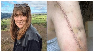 Imagem Mulher descobre que não tinha câncer após fazer 2 anos de tratamento