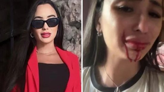 Ex\u002Ddançarina do Faustão pede ajuda após ser atacada com facada no rosto pela própria mãe