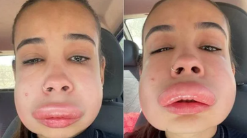 Reprodução / Redes Socias