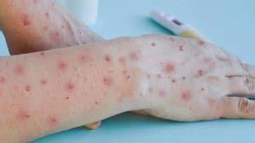 Reprodução/TV Anhanguera