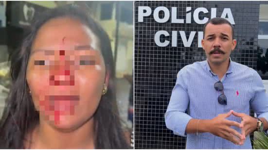 Reprodução