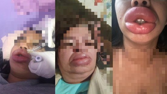 Foto: Divulgação/PCMS