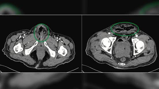 Urology Case Reports
