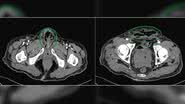Urology Case Reports