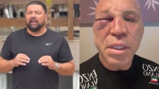 Reprodução/ redes sociais
