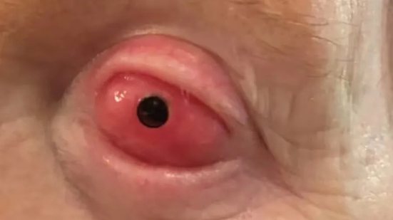 Divulgação/Greg Moloney/Providence Health Care