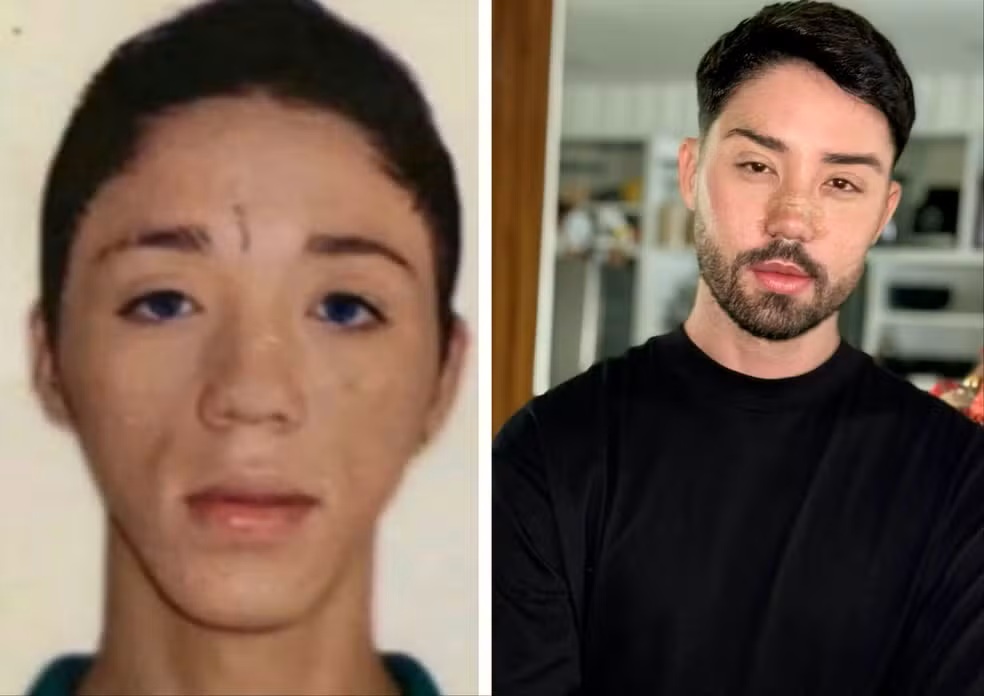 Antes e depois