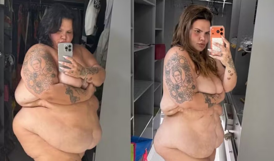 antes e depois