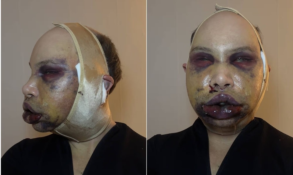 Reprodução | Redes Sociais