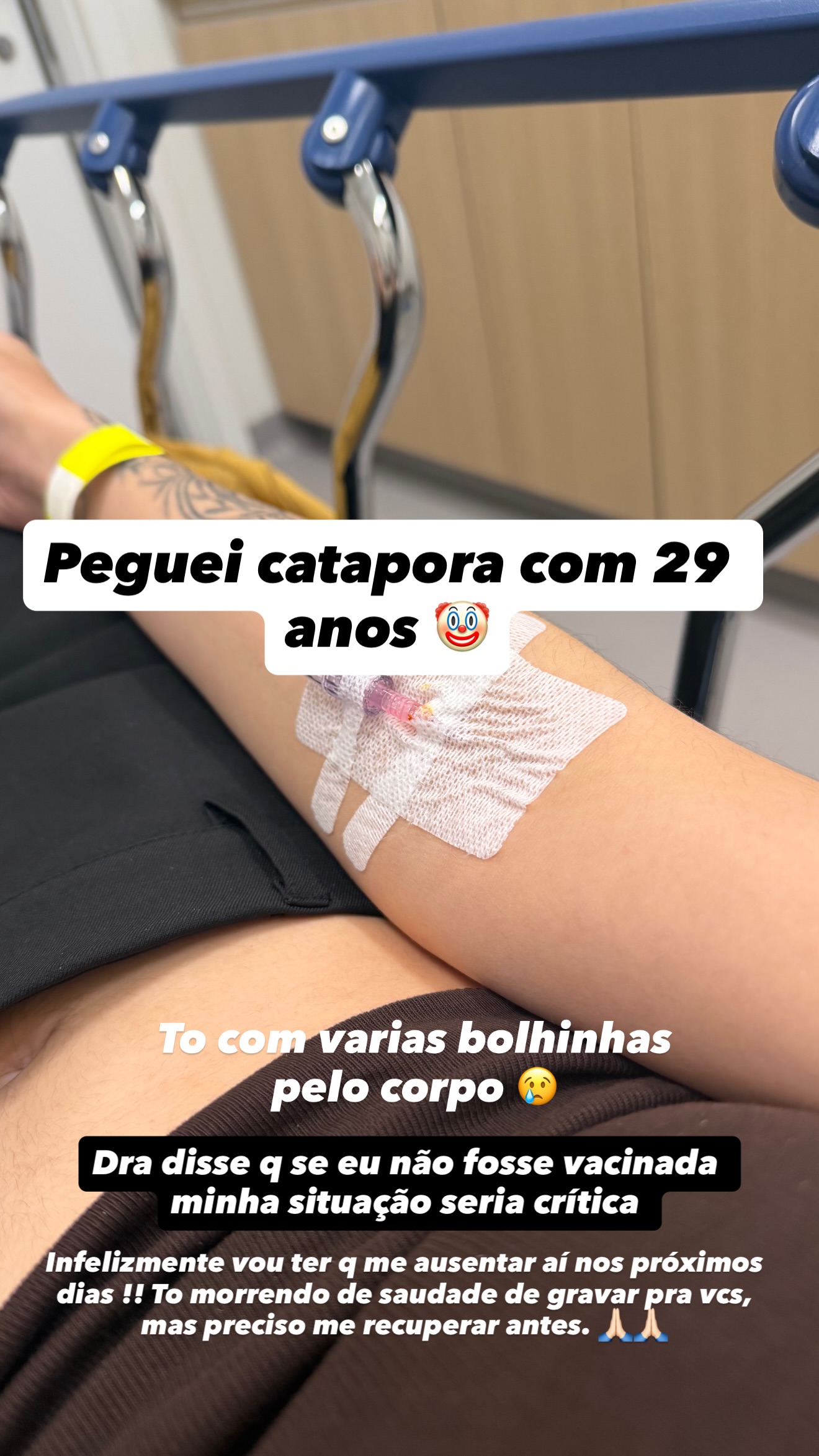 camila pudim catapora