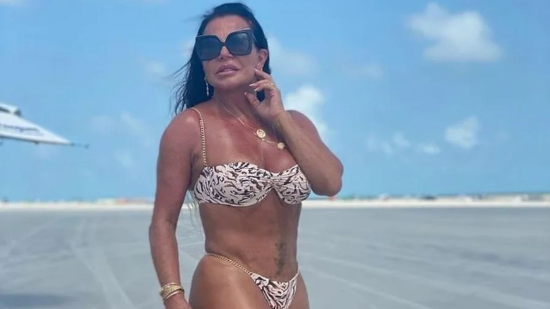 Gretchen choca ao detalhar cirurgia íntima: “Ela tá sorrindo”
