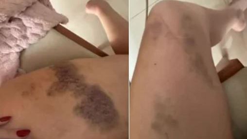 Reprodução/Redes Sociais