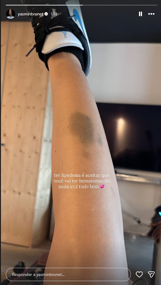 Yasmin Brunet — Foto ReproduçãoInstagram