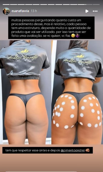 HARMONIZAÇÃO GLUTEA
