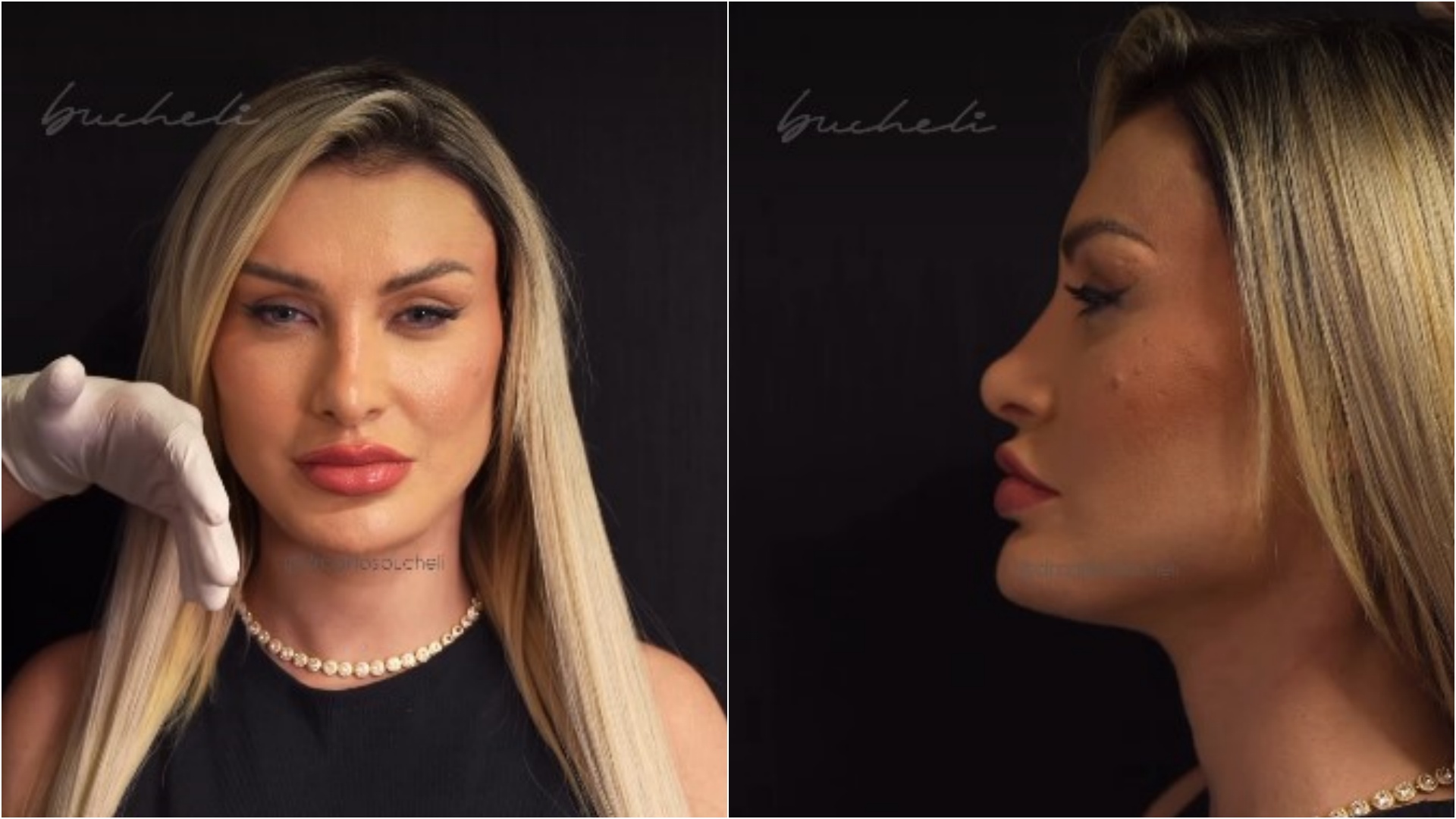 andresa
