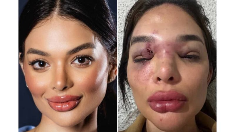 Empresário preso após acusação de agressão à esposa é alvo de decisão dura de juíza