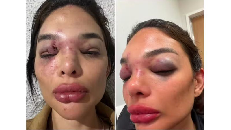 Empresário preso após acusação de agressão à esposa é alvo de decisão dura de juíza