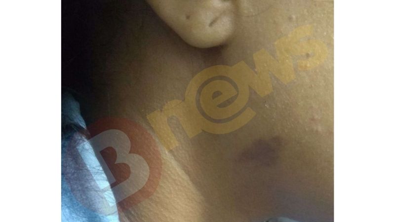 MARCA DEIXADA NO CORPO DA VÍTIMA