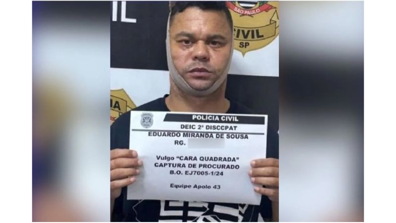 Criminosos apostam em harmonização facial para escapar da polícia