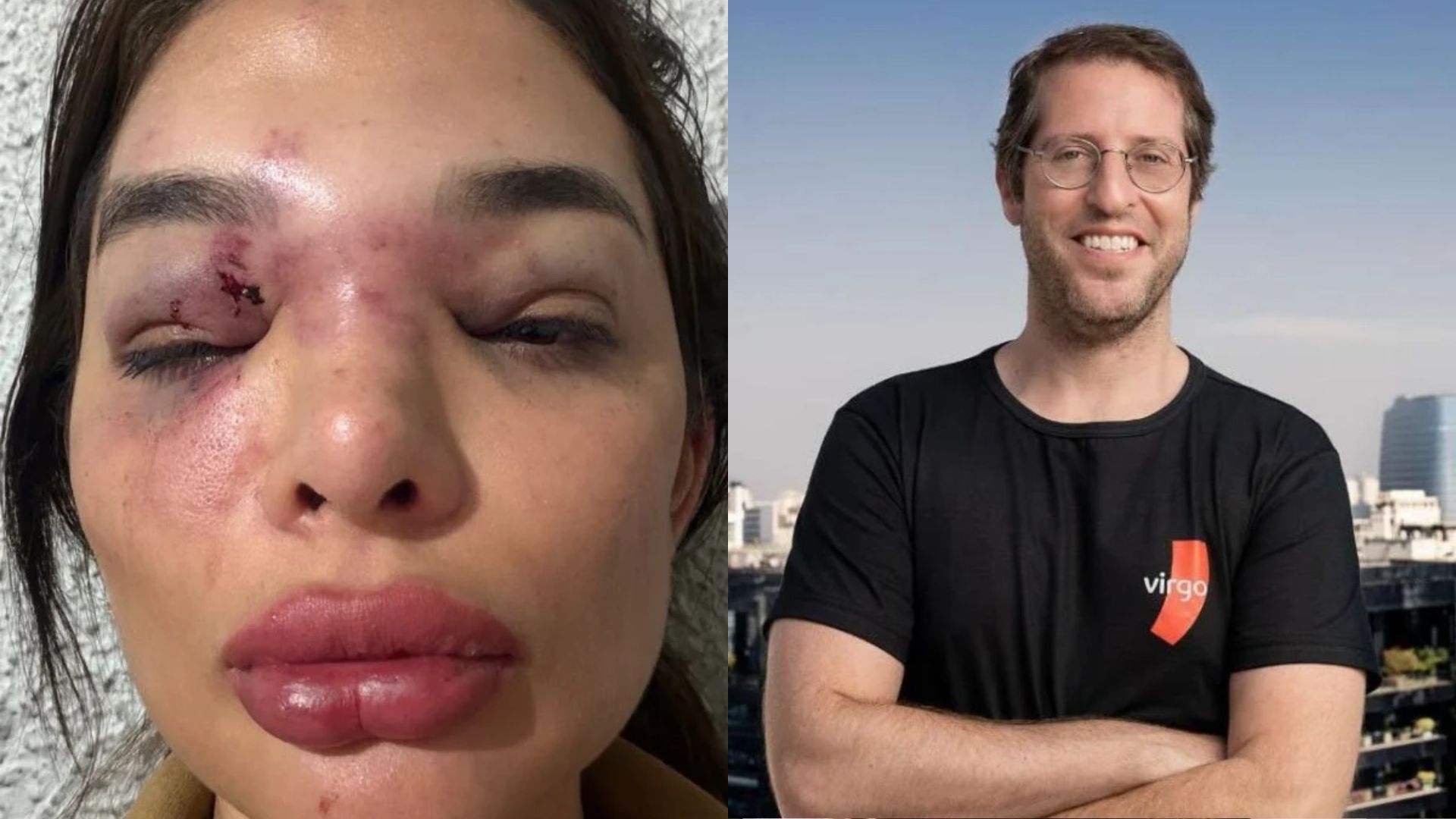 Dentista é agredida por marido e fica com o rosto desfigurado • Reprodução/redes sociais