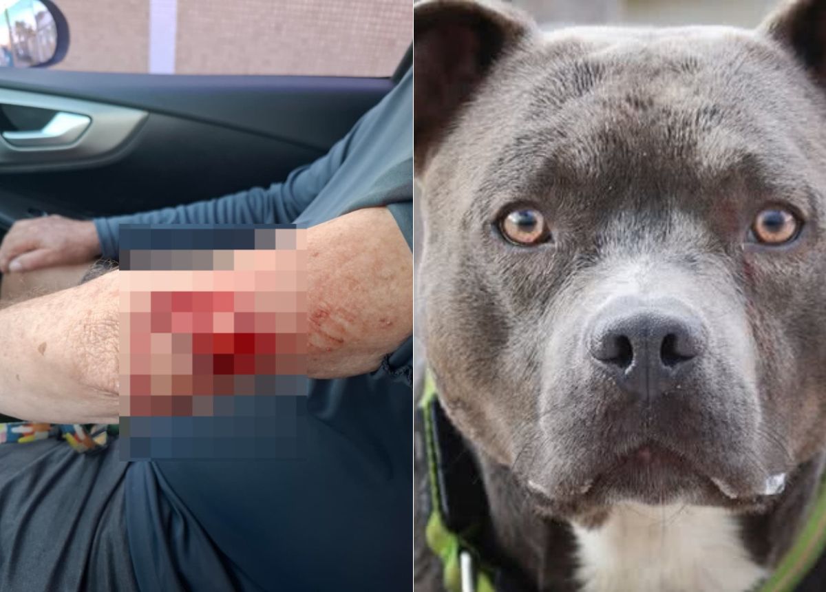 Pitbull se solta e ataca idoso na praia de Stella Maris - Foto