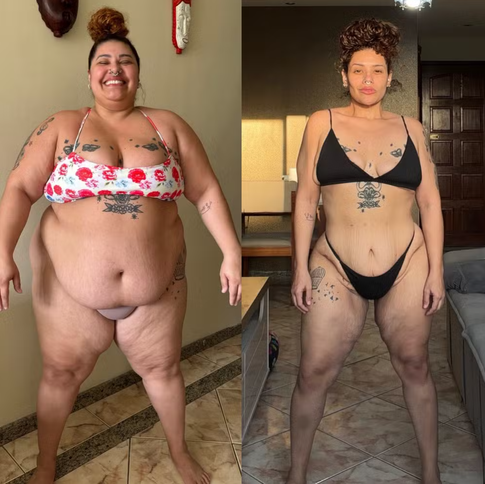 Cantora baiana exibiu mudanças no corpo após cirurgia bariátrica e processo de emagrecimento iniciado em 2024 — Foto: Reprodução/Instagram