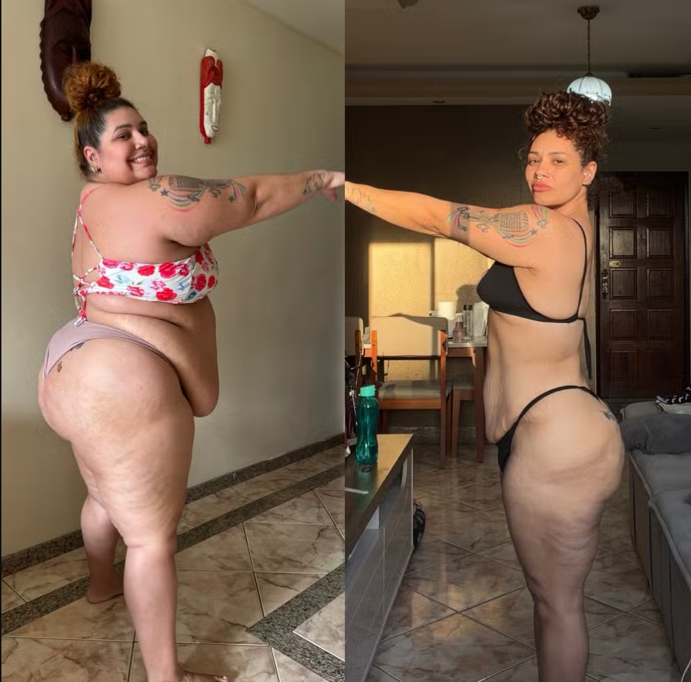 Aila Menezes compartilhou registros de antes e depois para mostrar a transformação após perder 90 kg — Foto: Reprodução/Instagram