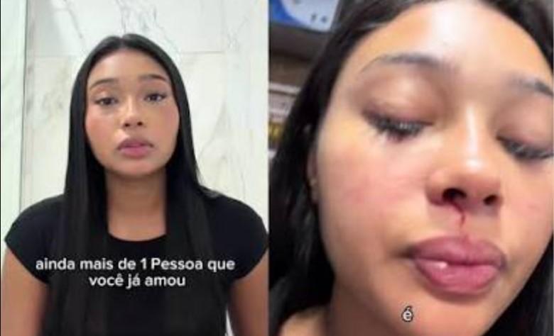 marcelle