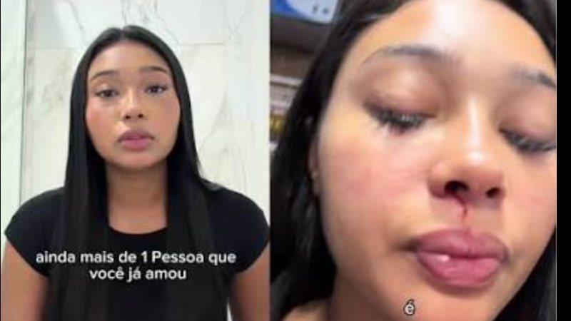 Ex-mulher de Felipe Teresa, do Palmeiras, Marcelle Barbosa denuncia agressão: “Um soco”