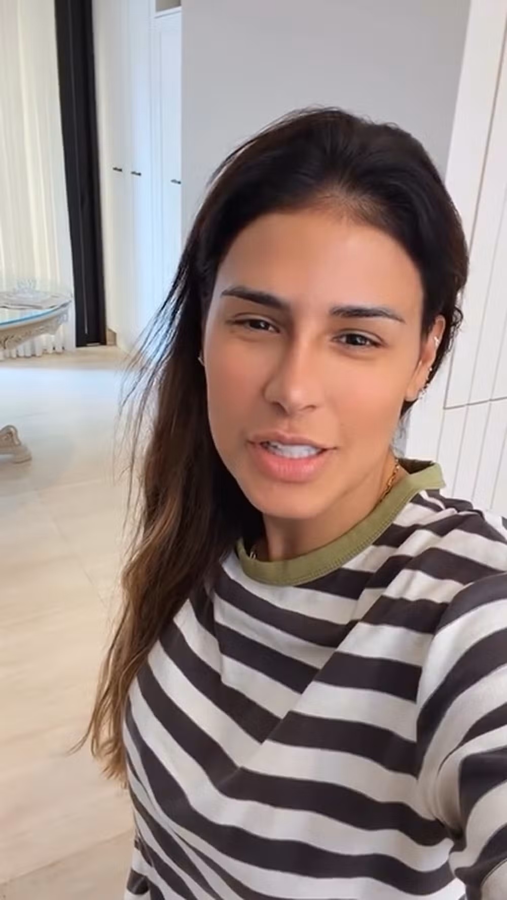 Simone Mendes aparece sem curativos e revela como ficou o nariz dias depois do procedimento estético
