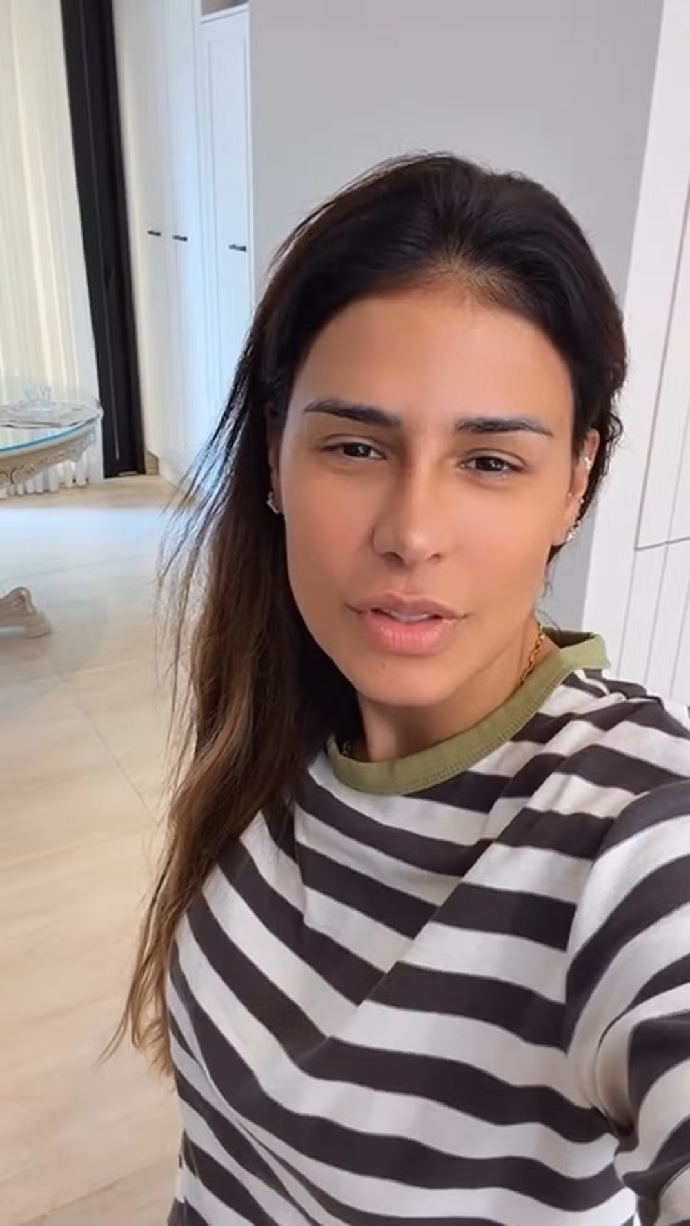 Simone Mendes aparece sem curativos e revela como ficou o nariz dias depois do procedimento estético