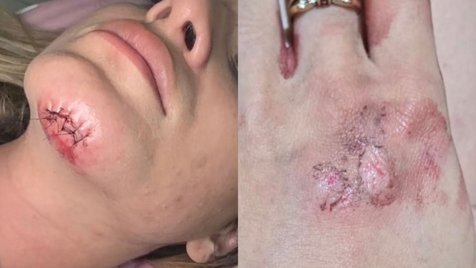 Influenciadora denuncia ex por agressão e diz ter sido arrastada por mais de 100 metros 
