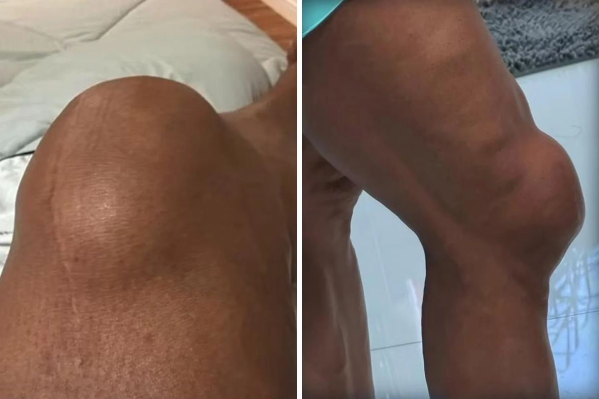 Foto: Reprodução /  redes sociais