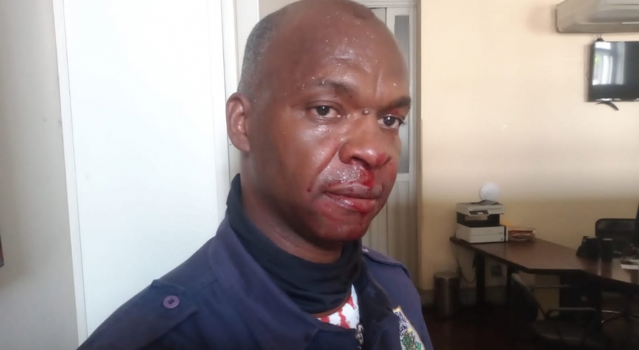 Guarda Municipal acusa assessor parlamentar de agressão