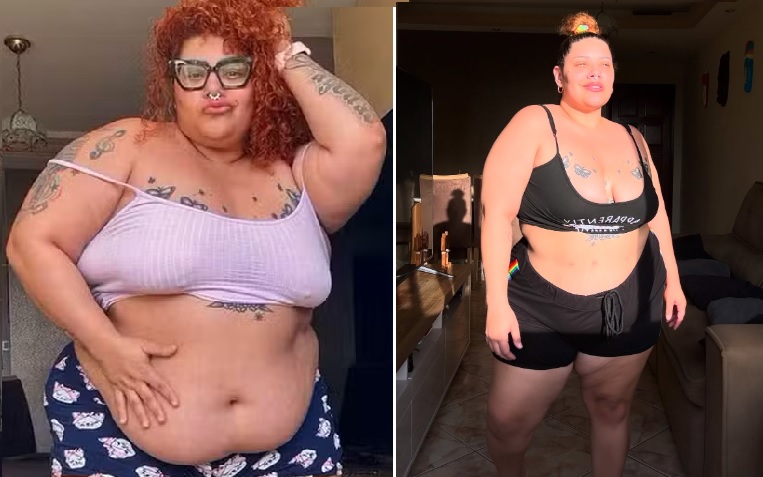 Aila Menezes antes da bariátrica (à esquerda) e oito meses depois da cirurgia (à direita) — Foto: Reprodução/Instagram