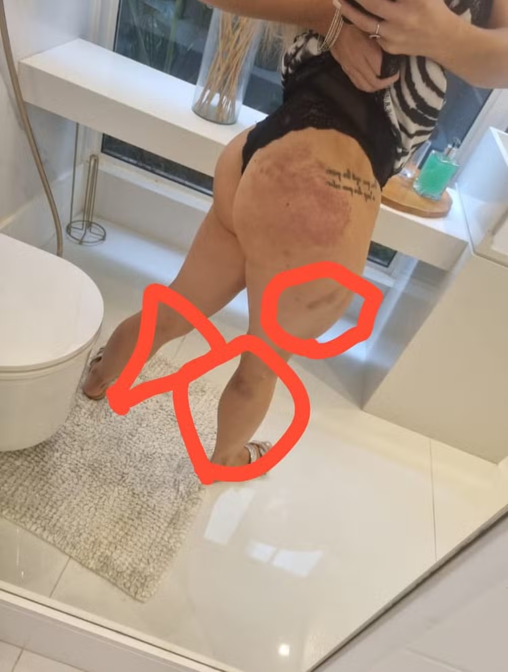 hemaotmas de larissa