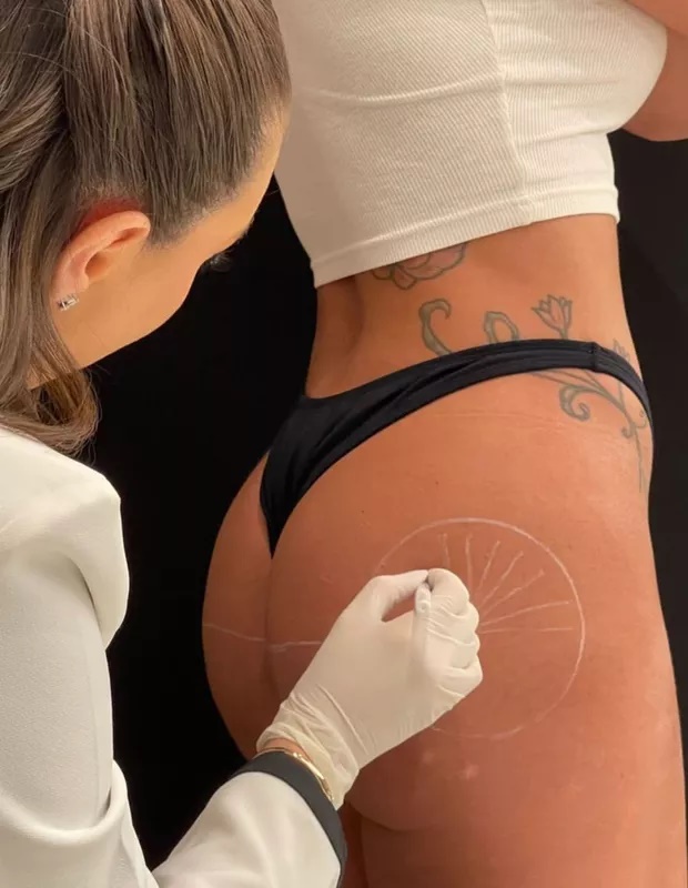 bumbum mari gonzalez