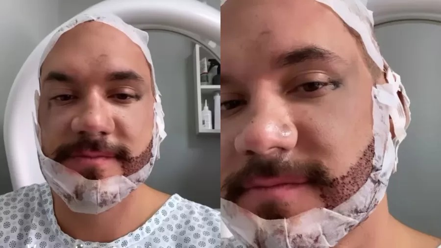 eliezer transplante